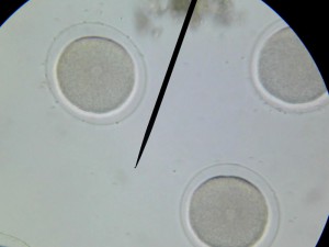 Observation microscopique d'ovules fécondées (X400) : la membrane de fécondation empêchant la polyspermie (fécondation par plusieurs spermatozoïdes) est nettement visible.