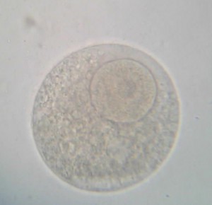 Observation microscopique d'un ovule d'oursin (X400) : on distingue très bien le noyau volumineux et le nucléole en son centre