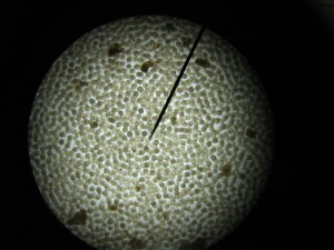 Observation de la récolte d'ovules (X40)
